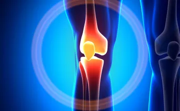 Picture of an x-ray